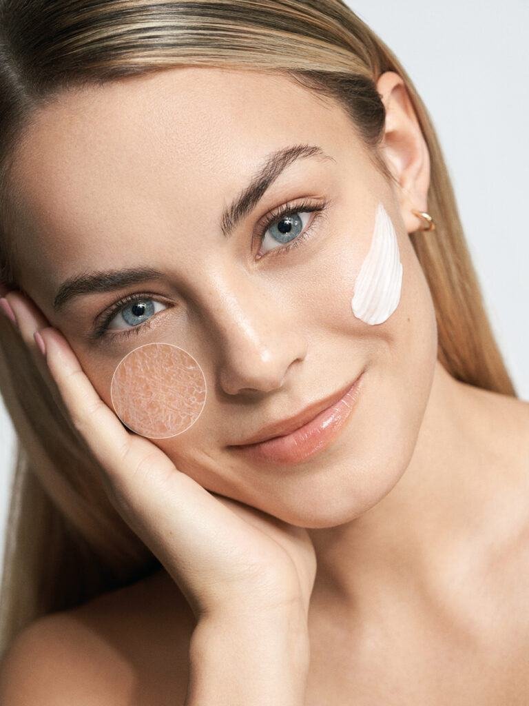 PIEL FACIAL SECA Y ZONAS DE PIEL SECA DEL CUERPO: CAUSAS Y CONSEJOS PARA UN CUIDADO ADECUADO